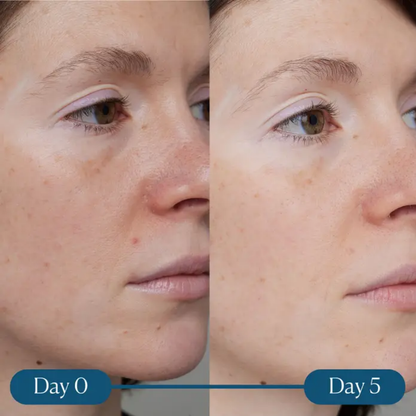 Elemis Dynamic Resurfacing Super-C Serum